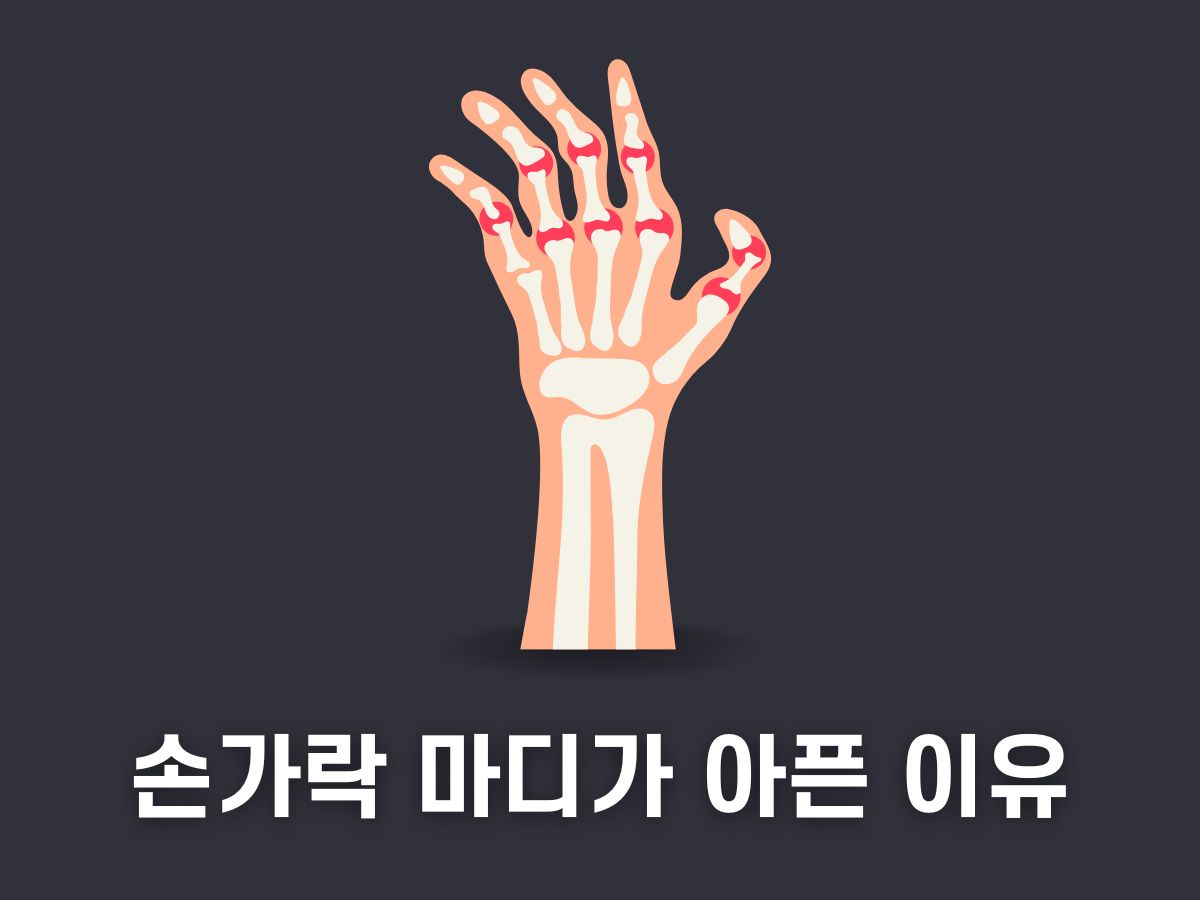 손가락 마디가 아픈 이유