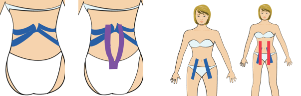 허리통증 2 (근육이 한쪽으로 당겨서 생기는 경우)