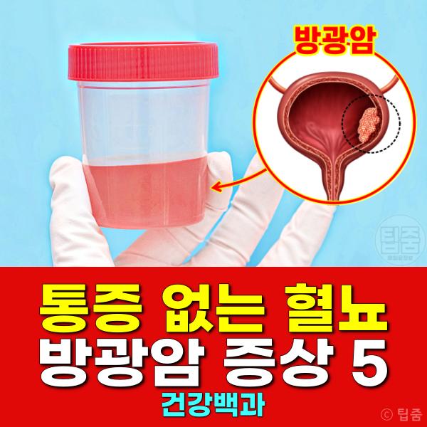 방광암 증상 혈뇨