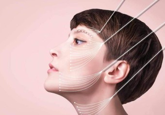 실리프팅 레이저리프팅