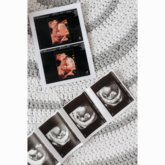 임신 주차별 증상