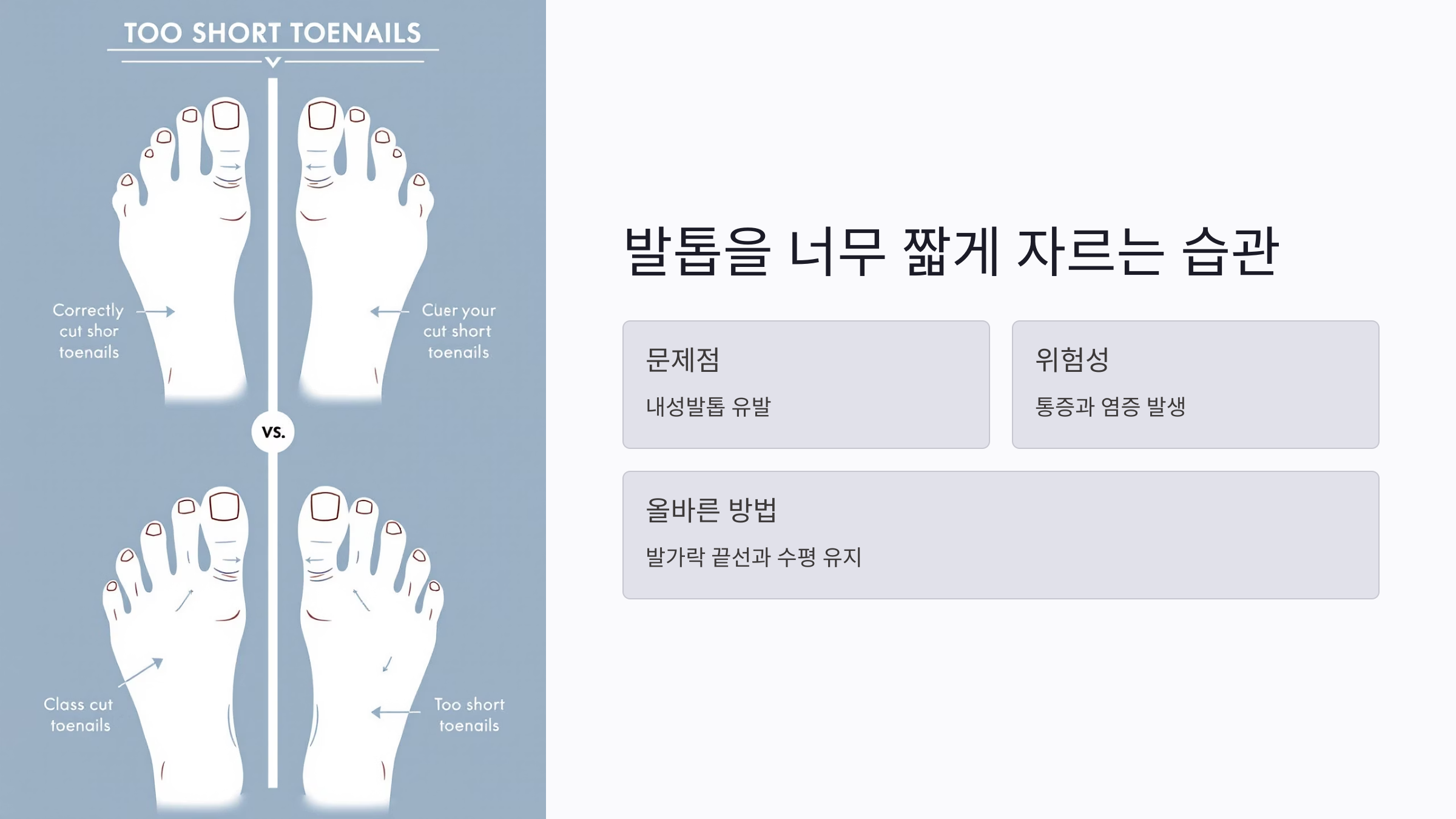 발톱을 너무 짧게 자르는 습관