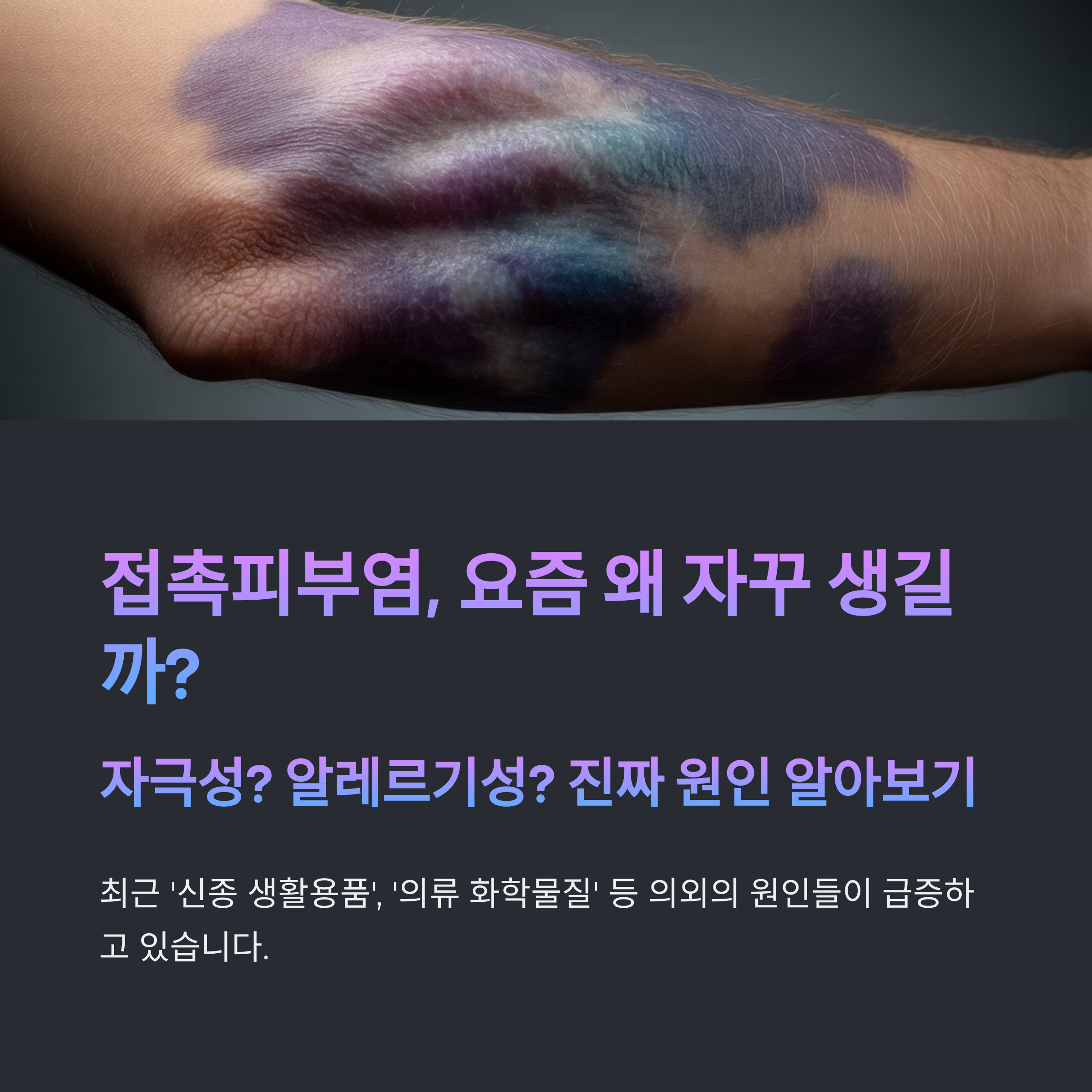 접촉피부염