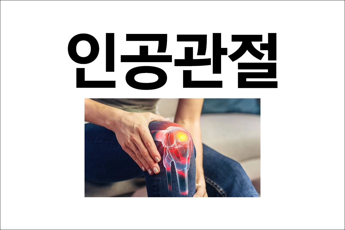 인공관절 수술