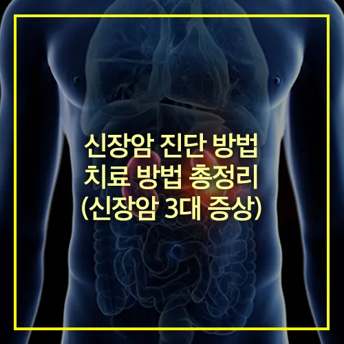 신장암 진단 방법 치료 방법 신장암 3대 증상