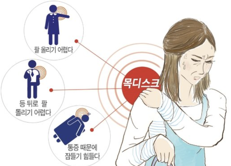 목디스크 증상 2