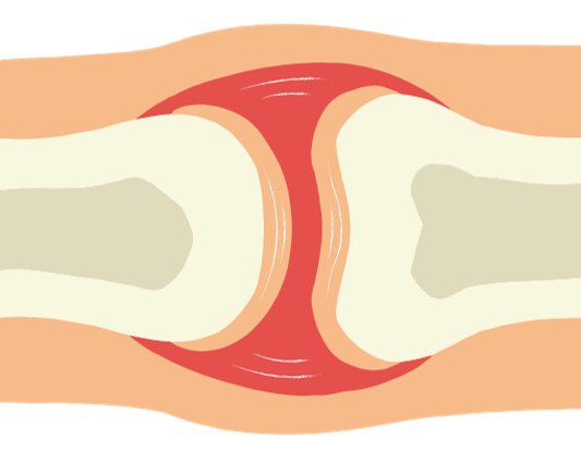 프로테오글리칸-이미지-예시