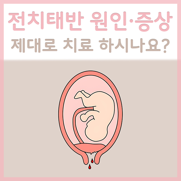 전치태반의-태아모습