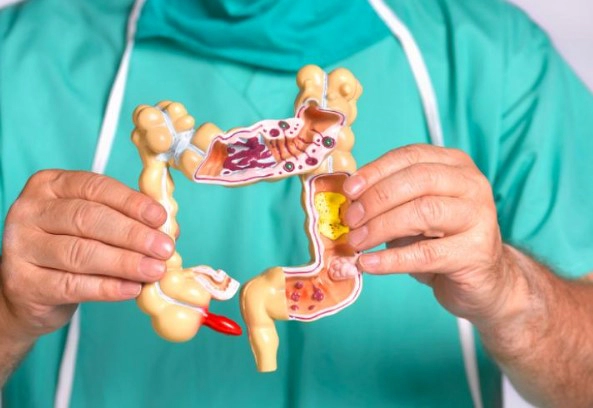 대장내시경 전 음식 주의사항