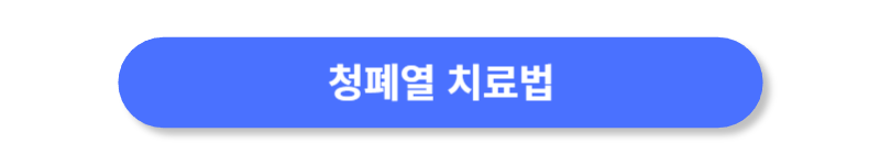 버튼