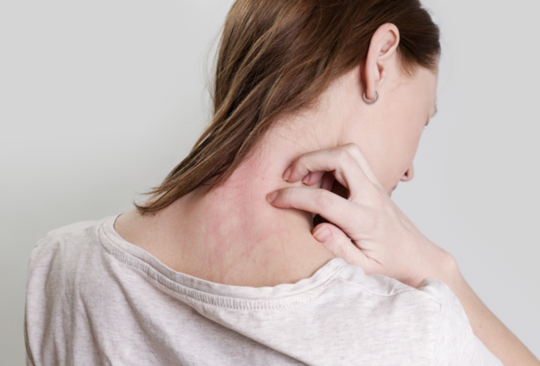 뒷목을 긁고있는 여성