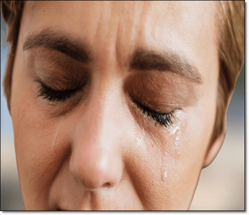 결막결석 제거한 여성