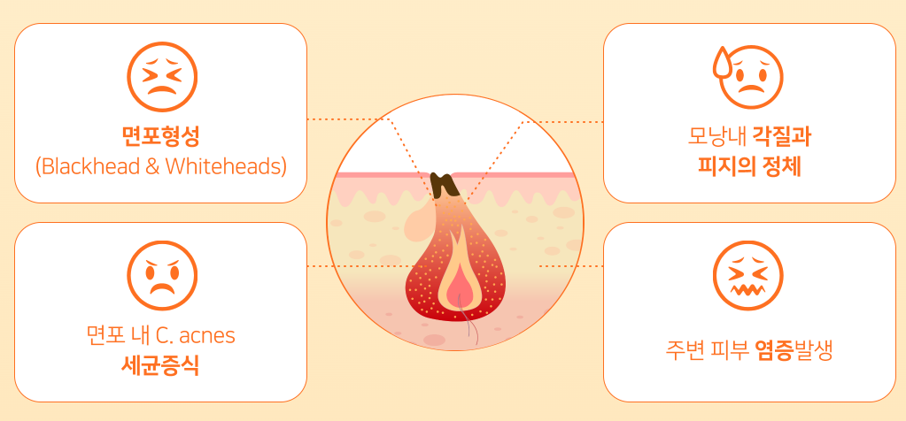 아젤리아-크림-효과