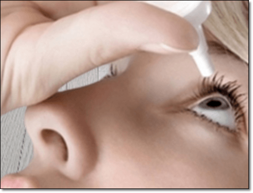 안약 넣는 여자