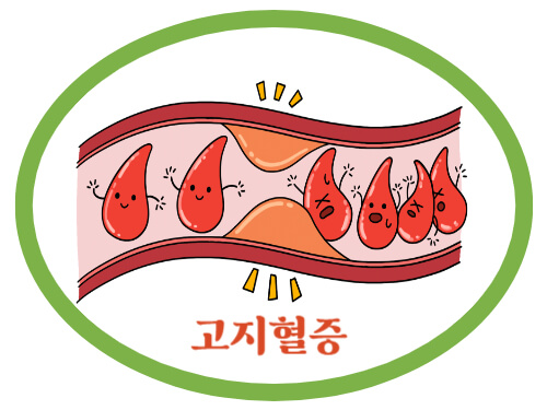 고지혈증