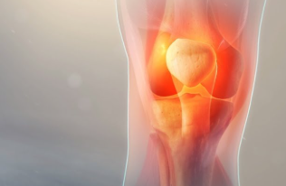 콘드로이친 효능