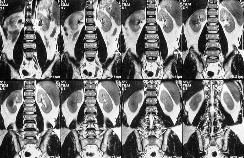 MRI 건강보험 적용&amp;#44; MRI 비용&amp;#44; MRI 실비보험 적용&amp;#44; MRI MRA의 차이점&amp;#44; MRI MRA 차이&amp;#44; MRI 촬영 주의사항&amp;#44; MRI와 CT 차이점&amp;#44; MRI 촬영시간&amp;#44; MRI CT 차이&amp;#44; MRI 검사전 금식&amp;#44; MRI 금식