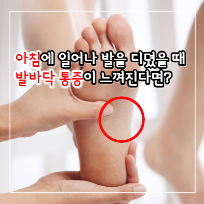 족저 근막염 증상과 치료 방법 11가지