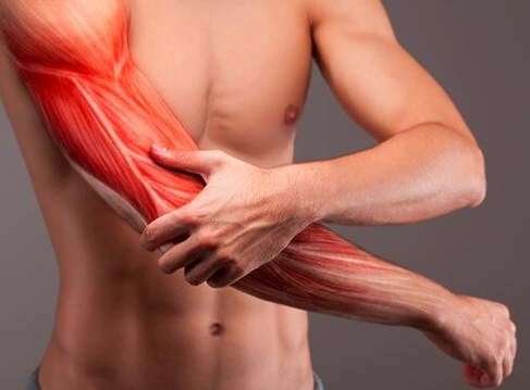 섬유근육통 진단