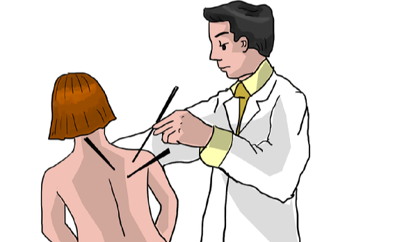 무면허로 침 시술을 하다 환자를 숨지게 한 목사가 항소심에서도 징역형의 집행유예를 선고받았다. 본 기사와 무관한 이미지. [사진=픽사베이]