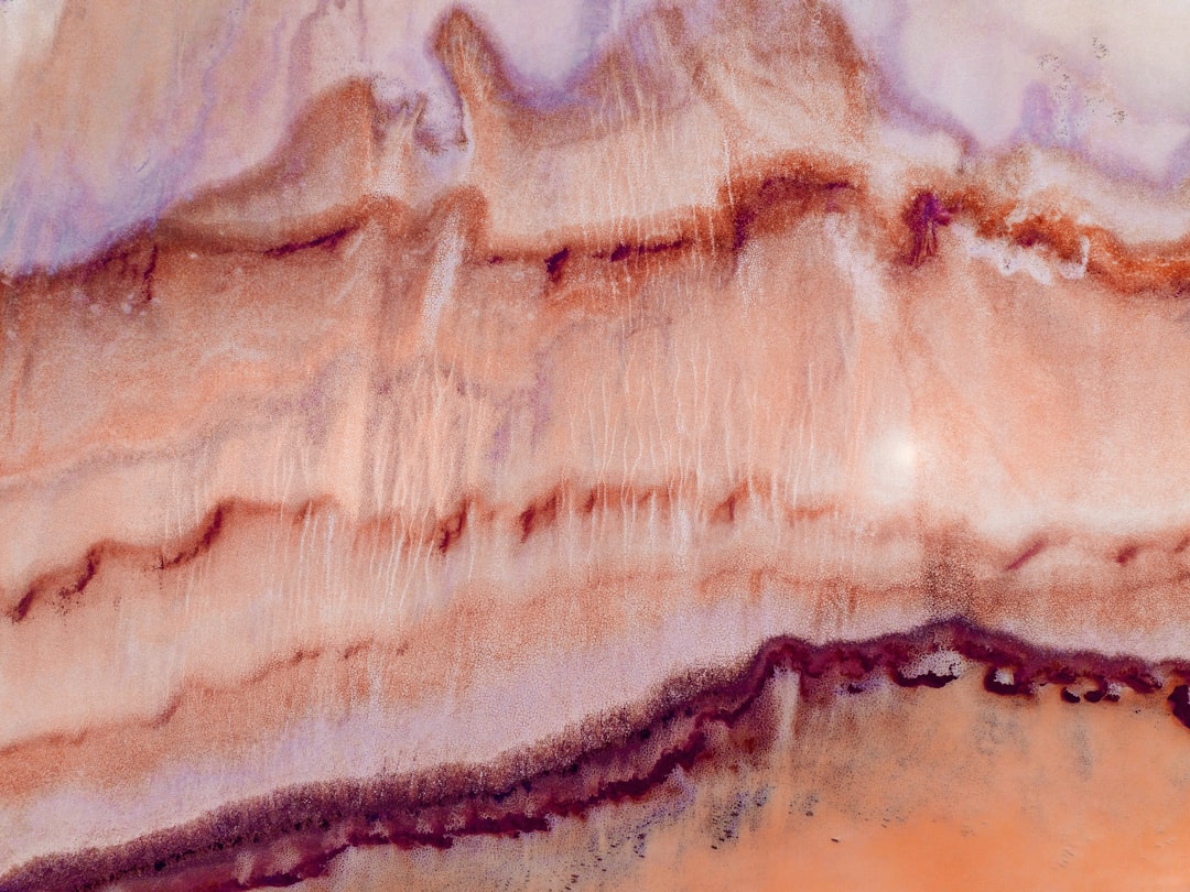 Xerostomia