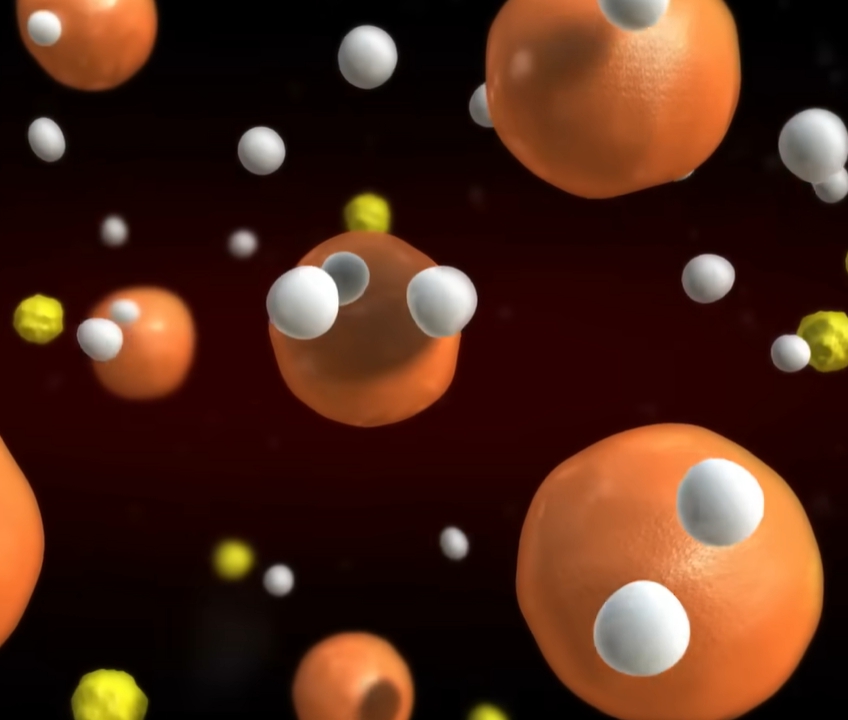 중성지방 정상수치