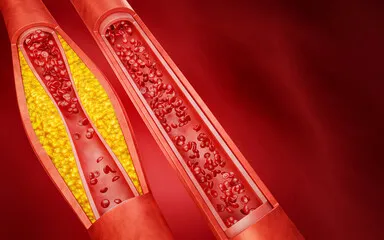 건강을 위협하는 나쁜 식습관