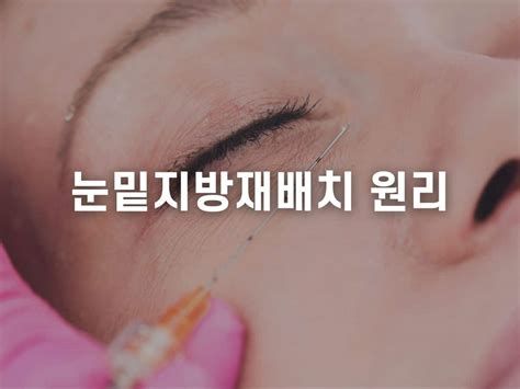 눈밑레이저
