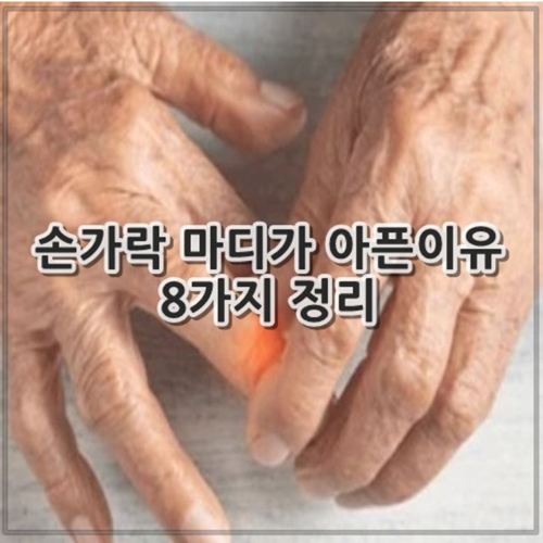 손가락 마디가 아픈이유 8가지 정리
