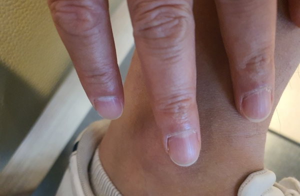 발목을-주무르는-모습