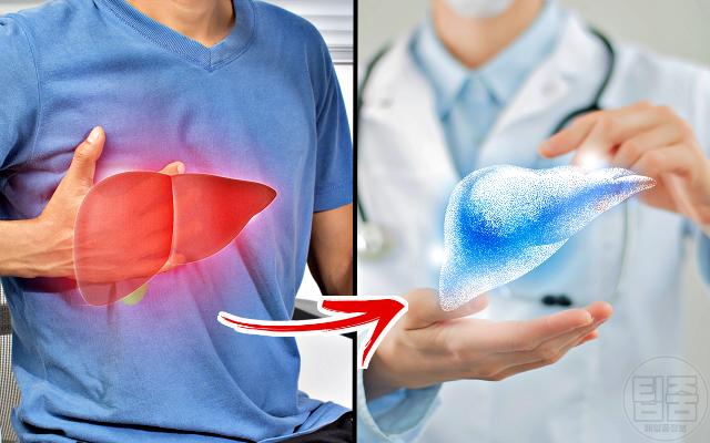 간 해독제 음료 추천 간 이식 전문의