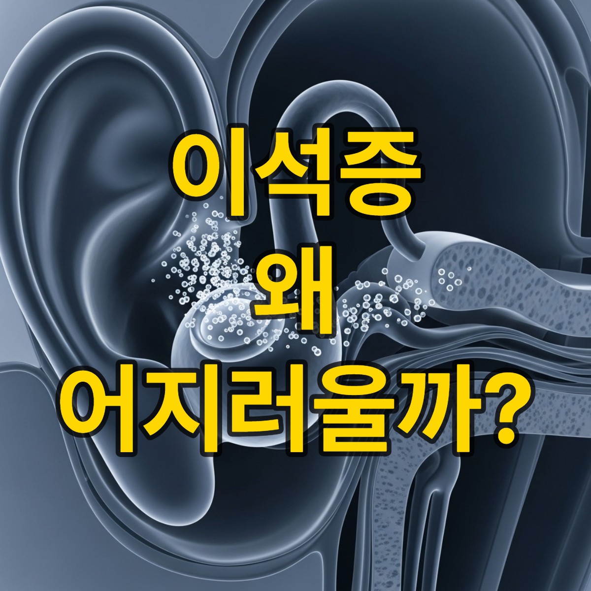 이석증 원인 알아보기