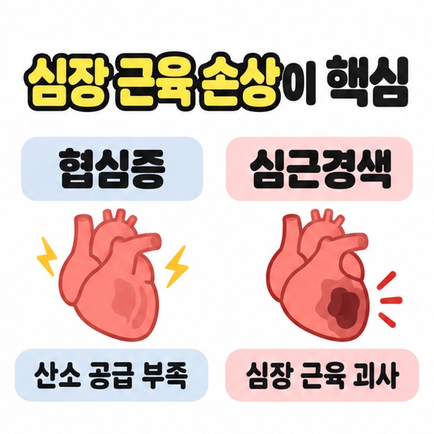 협심증의 산소 공급 부족과 심근경색의 심장 근육 괴사를 두 심장 그림과 짧은 문구로 비교한 이미지