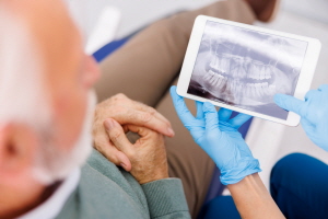 임플란트 의료보험적용대상