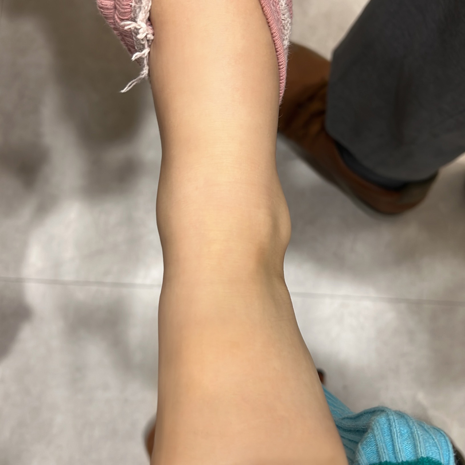 피부과 간지럼증 가려움증 치료방법