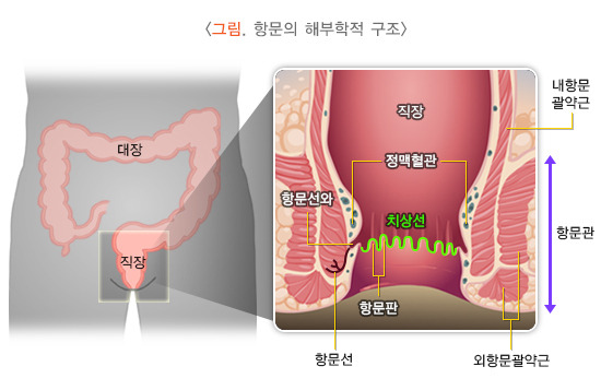 치핵 원인, 증상, 치료방법