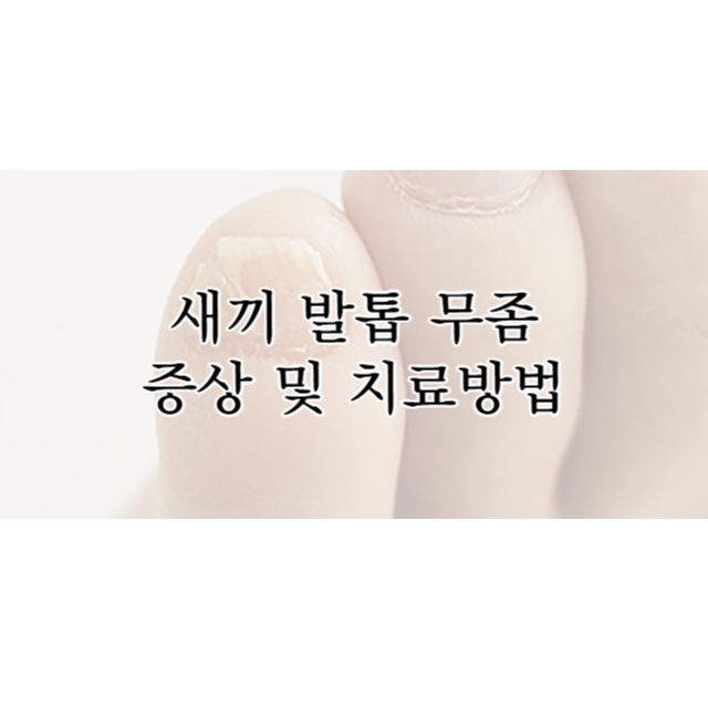새끼발톱-무좀-증상-치료방법