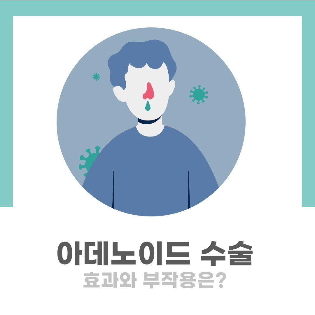 아데노이드 수술
