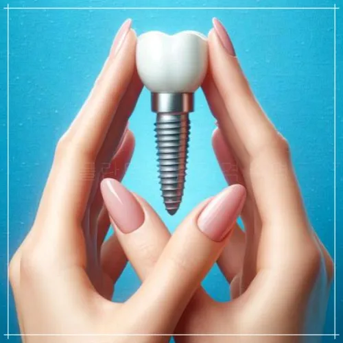 티타늄 임플란트: 특징&amp;#44; 비용&amp;#44; 수명3