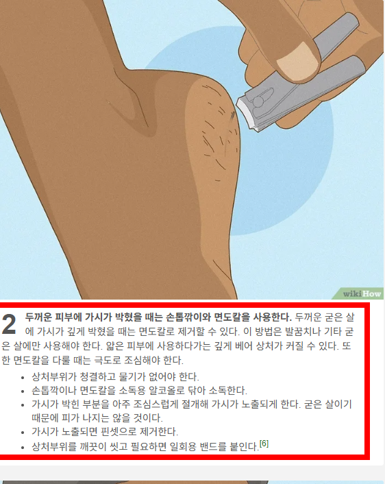 손가락 가시 빼는법 소개