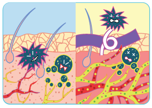 테이핑의 일반적 효과