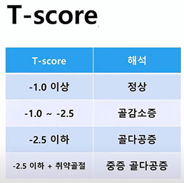 골다공증 검사 비용
