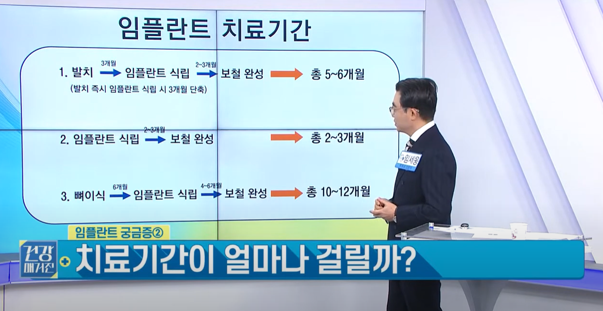 임플란트 치료 기간
