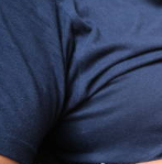 복부팽만 호흡곤란 증상