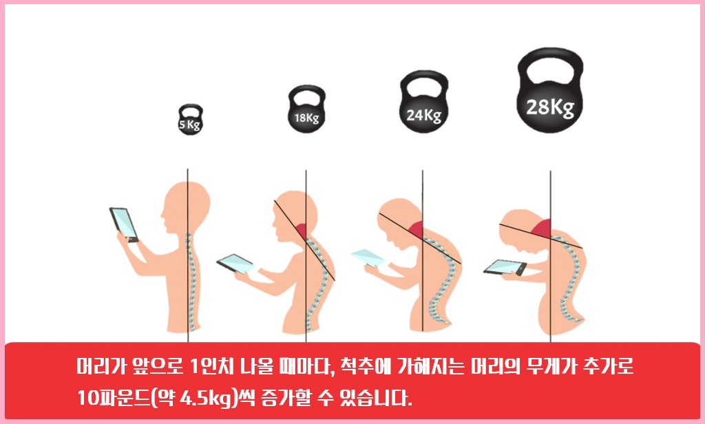 거북목 교정 완벽 가이드: 효과적인 운동법과 팁
