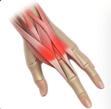 손가락 마디 아픈 이유 5가지6