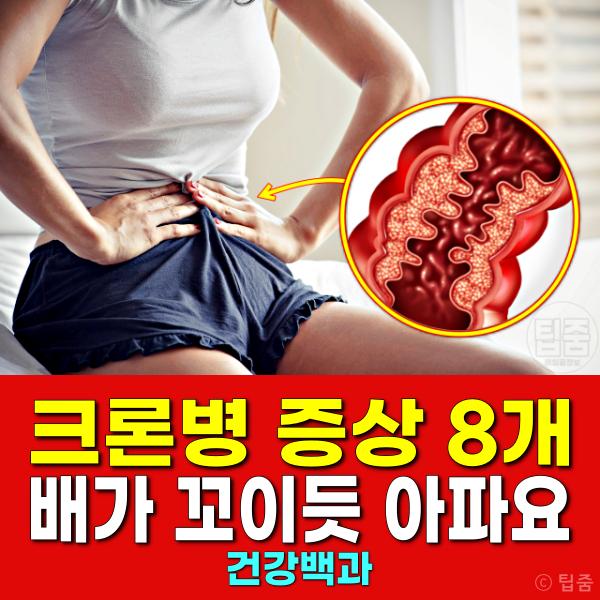 크론병 증상