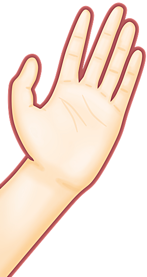 손목터널증후군-이미지