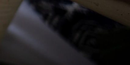 류마티스관절염