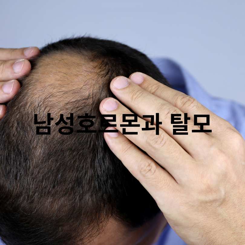 나이별 남성호르몬 수치 변화와 탈모의 연관성